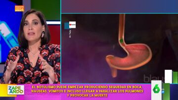 Boticaria García explica la realidad del bótox: "Lo fabrica una bacteria que es uno de los venenos más poderosos que hay"