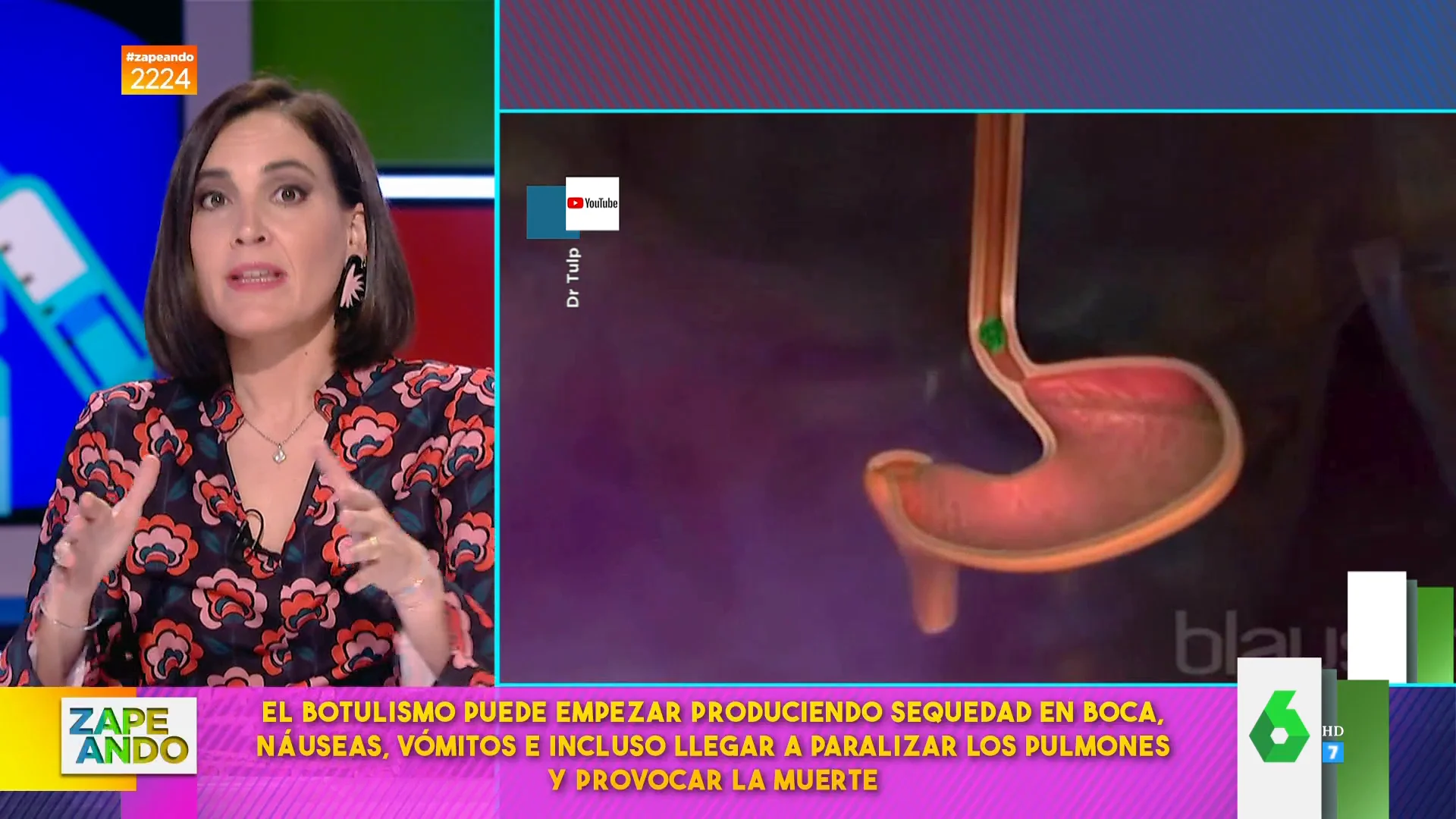 Boticaria García explica la realidad del bótox: "Lo fabrica una bacteria que es uno de los venenos más poderosos que hay"