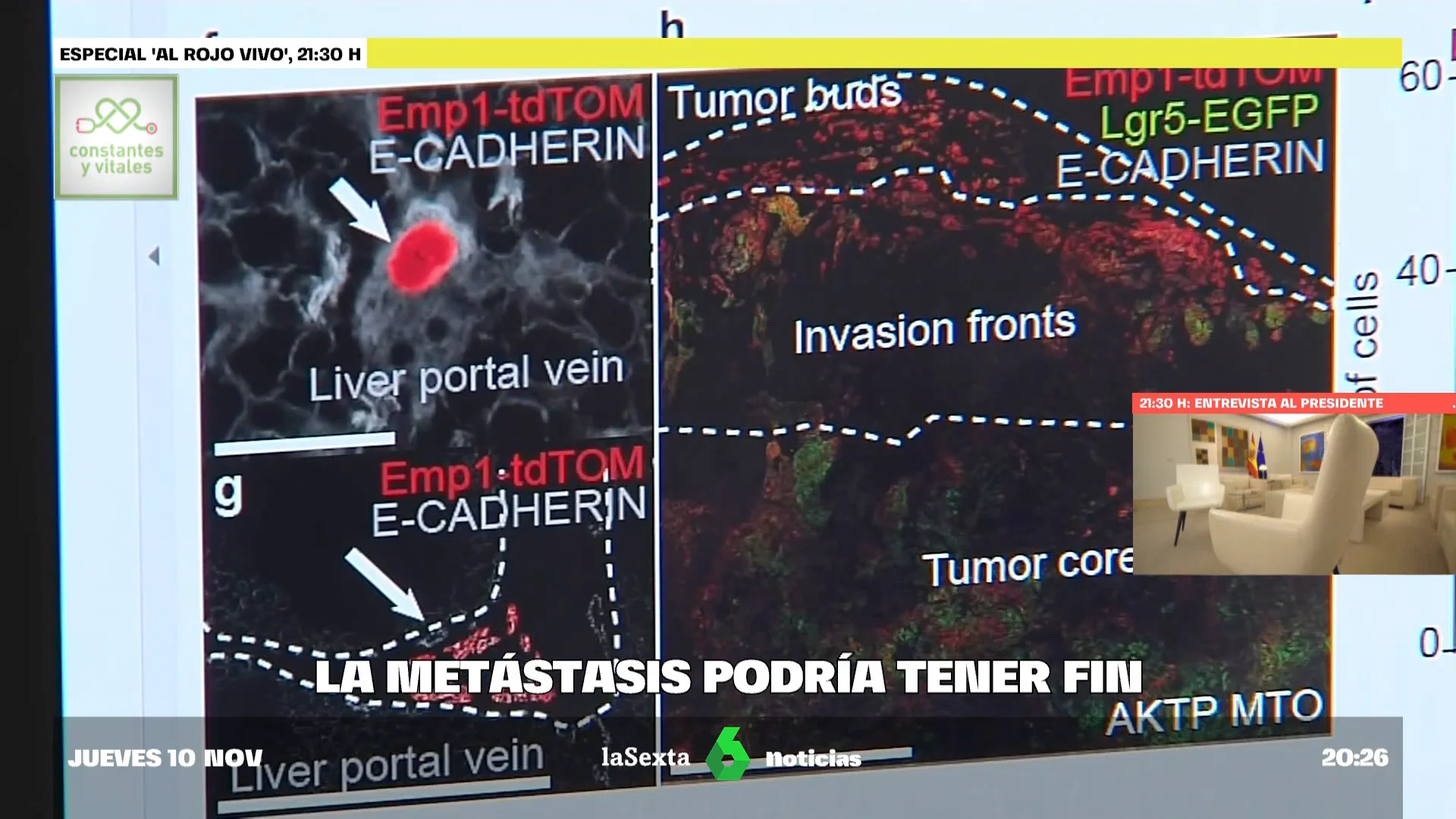 Científicos españoles descubren células malígnas que se desprenden del cáncer de colon y se propagan a más órganos