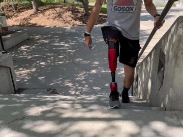 pierna biónica para personas amputadas por encima de la rodilla