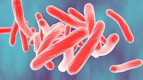Mycobacterium tuberculosis Mycobacterium tuberculosis