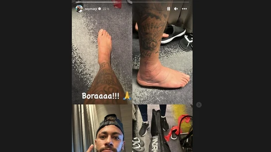 Estado del tobillo de Neymar Estado del tobillo de Neymar