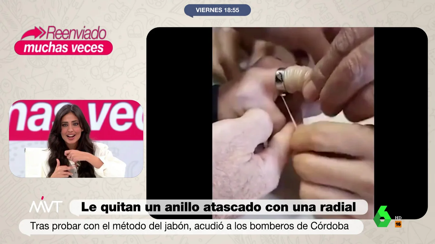 la sorprendente técnica de los bomberos para quitar un anillo atascado en un dedo la sorprendente técnica de los bomberos para quitar un anillo atascado en un dedo