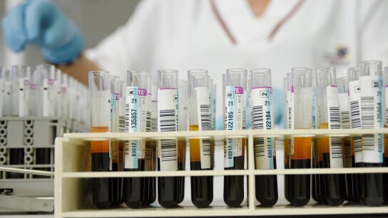 Un an&aacute;lisis de sangre rutinario permite diagnosticar Alzheimer en personas con s&iacute;ntomas tempranos