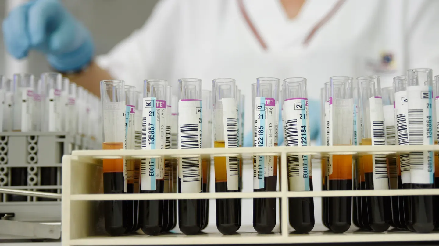 Un análisis de sangre rutinario permite diagnosticar Alzheimer en personas con síntomas tempranos Un análisis de sangre rutinario permite diagnosticar Alzheimer en personas con síntomas tempranos