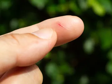 Corte en el dedo Corte en el dedo