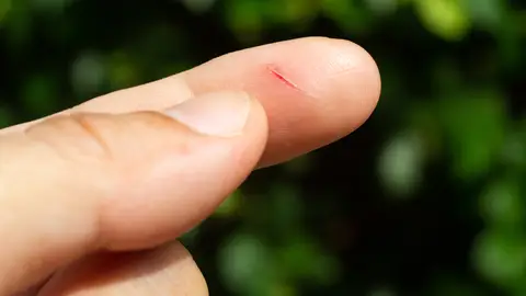 Corte en el dedo Corte en el dedo