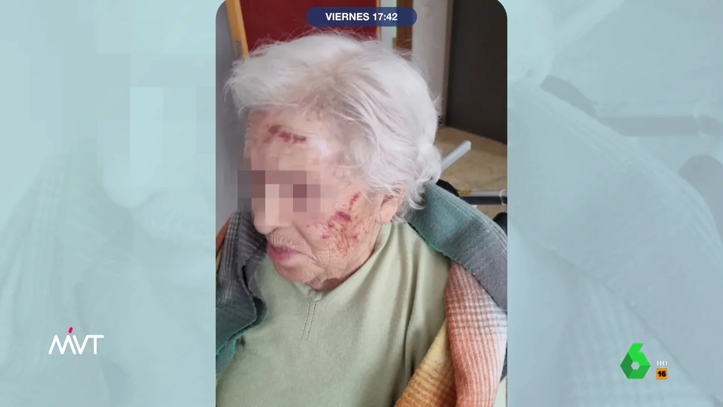 Mujer agredida en una residencia de mayores Mujer agredida en una residencia de mayores