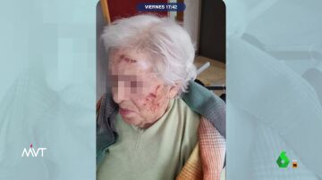 Mujer agredida en una residencia de mayores