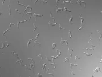 Células de ‘Trypanosoma brucei’ en cultivo observadas al microscopio Células de ‘Trypanosoma brucei’ en cultivo observadas al microscopio