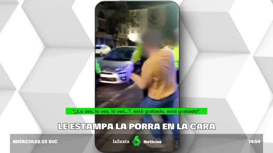 Investigan la actuación de un agente que estampó una porra en la cara a un hombre Investigan la actuación de un agente que estampó una porra en la cara a un hombre