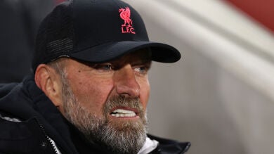 Jurgen Klopp