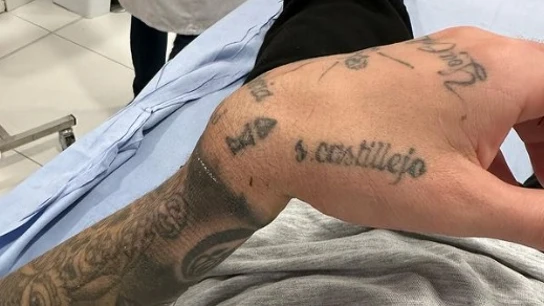La escalofriante fractura de muñeca de Samu Castillejo La escalofriante fractura de muñeca de Samu Castillejo
