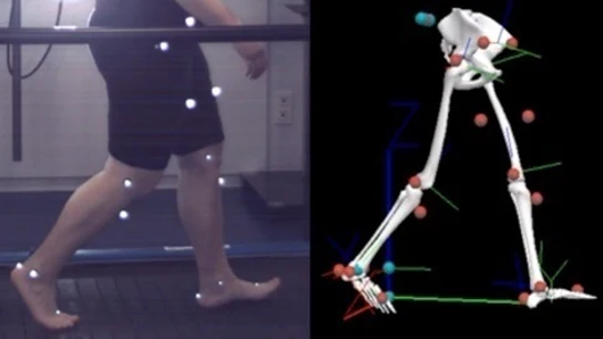 No solo los adultos sufren enfermedades reumáticas No solo los adultos sufren enfermedades reumáticas