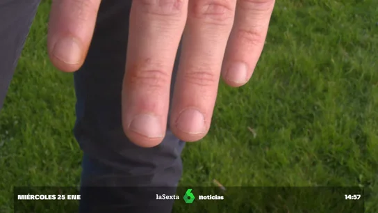 morderse las uñas morderse las uñas