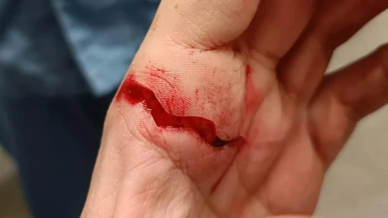 La mano del entrenador del CD Firgas La mano del entrenador del CD Firgas