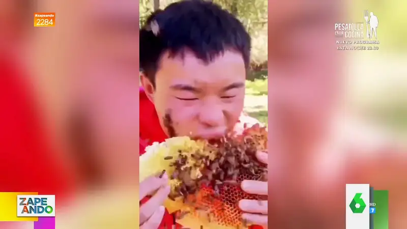 Así se le hincha la cara a un joven después de morder un panal infestado de abejas 