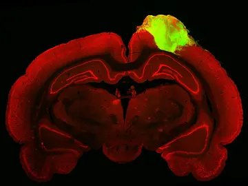 organoide cerebral humano injertado organoide cerebral humano injertado
