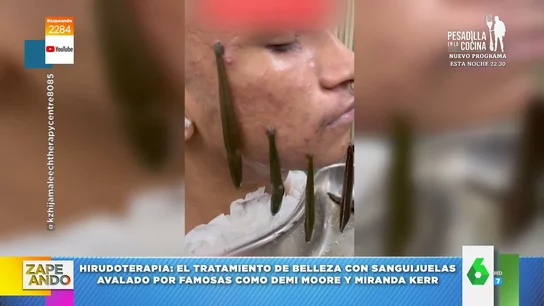 estos son los tratamientos de belleza más raros estos son los tratamientos de belleza más raros