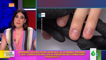 Boticaria García explica las consecuencias de morderse las uñas