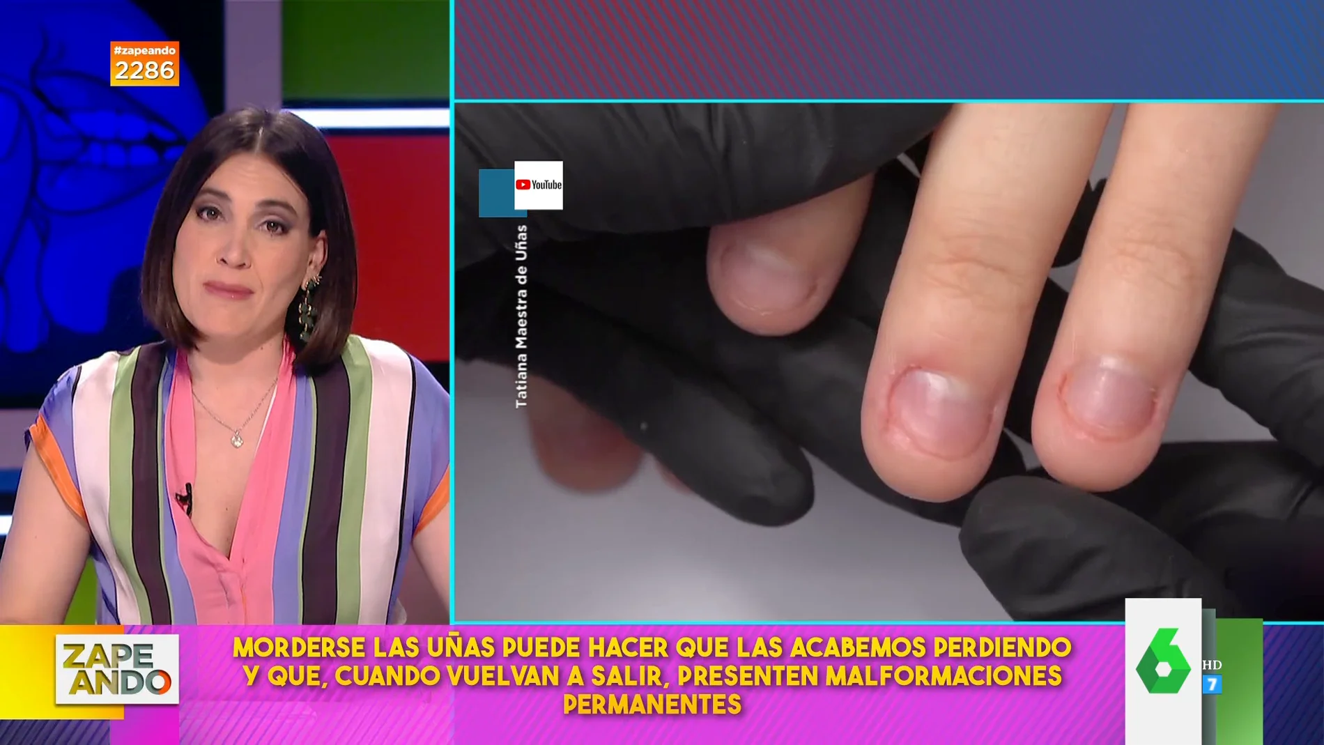 Boticaria García explica las consecuencias de morderse las uñas