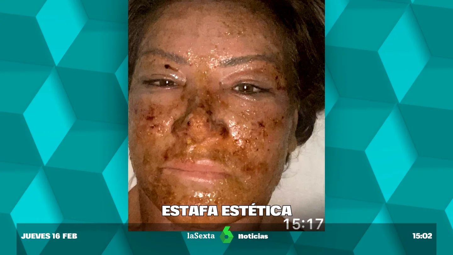 estafa estética estafa estética