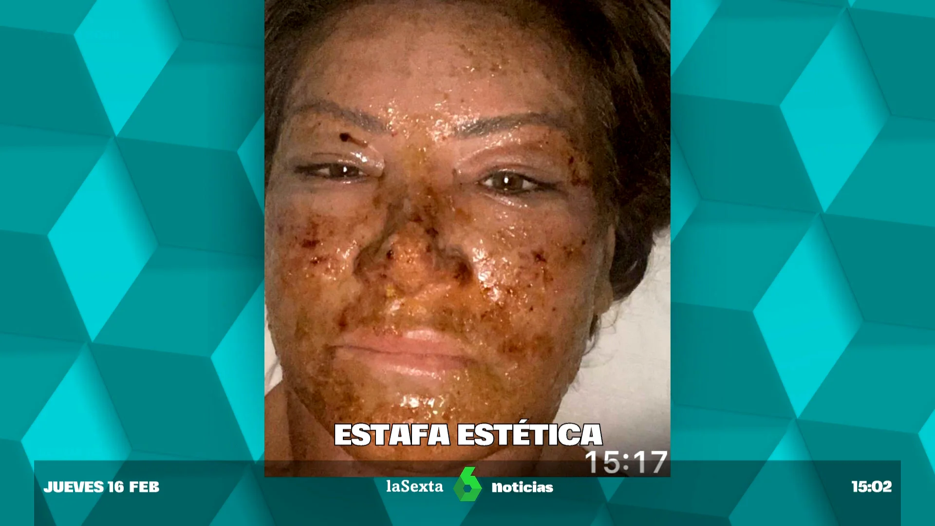 estafa estética