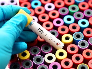 España guarda 130 cordones umbilicales resistentes a VIH para trasplantes