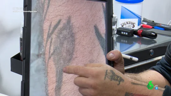 "Es un desastre, hay zonas dañadas": la indignación de un profesional al analizar el trabajo de un tatuador a domicilio "Es un desastre, hay zonas dañadas": la indignación de un profesional al analizar el trabajo de un tatuador a domicilio