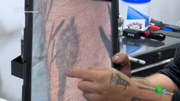 "Es un desastre, hay zonas dañadas": la indignación de un profesional al analizar el trabajo de un tatuador a domicilio