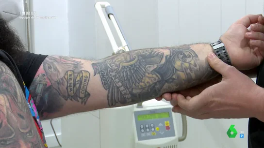 Arrepentidos de los tatuajes: así es el proceso de eliminación, su duración y coste Arrepentidos de los tatuajes: así es el proceso de eliminación, su duración y coste