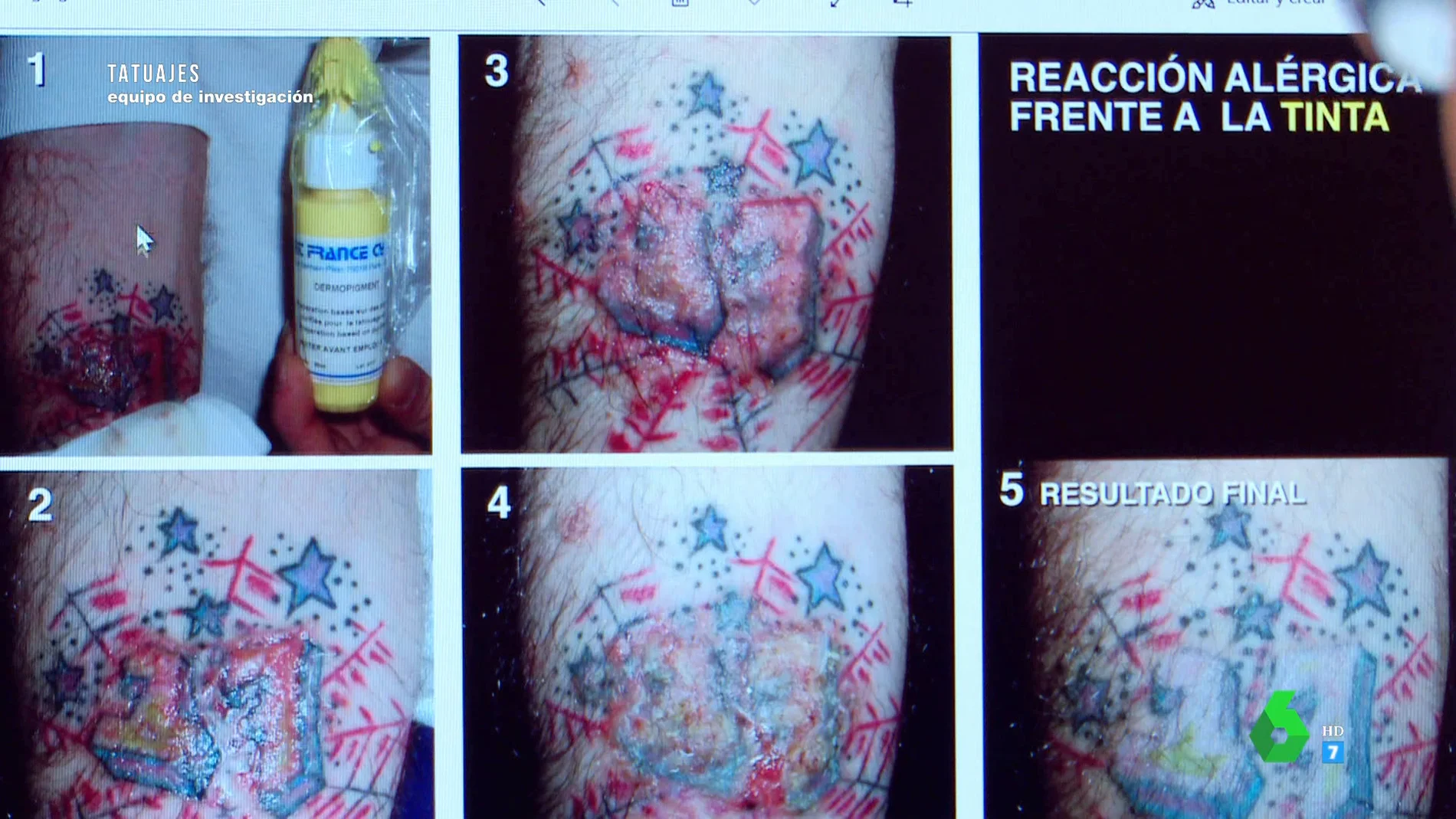 Por qué deberías hacer una foto del bote de tinta al tatuarte: la recomendación de un dermatólogo para evitar problemas