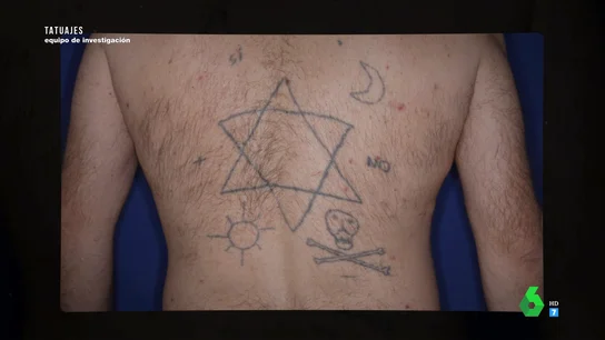 Tatuado por un amigo, en un cementerio, tras una noche de fiesta: el borrado de tatuaje más sorprendente Tatuado por un amigo, en un cementerio, tras una noche de fiesta: el borrado de tatuaje más sorprendente