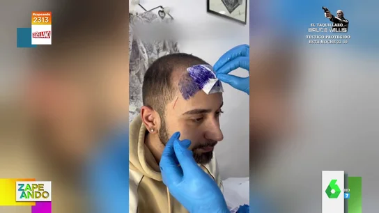 El tatuaje de flequillo: la nueva técnica para decir adiós a las entradas El tatuaje de flequillo: la nueva técnica para decir adiós a las entradas