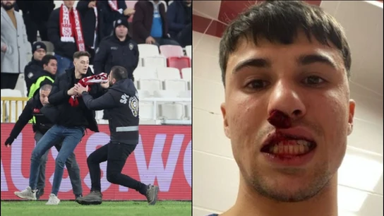 Momento en que el hincha corre hacia el jugado Alessandro Bianco con la nariz rota Momento en que el hincha corre hacia el jugado Alessandro Bianco con la nariz rota