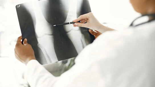 ¿Huesos más fuertes para prevenir la demencia? Una baja densidad ósea podría tener consecuencias en el cerebro ¿Huesos más fuertes para prevenir la demencia? Una baja densidad ósea podría tener consecuencias en el cerebro