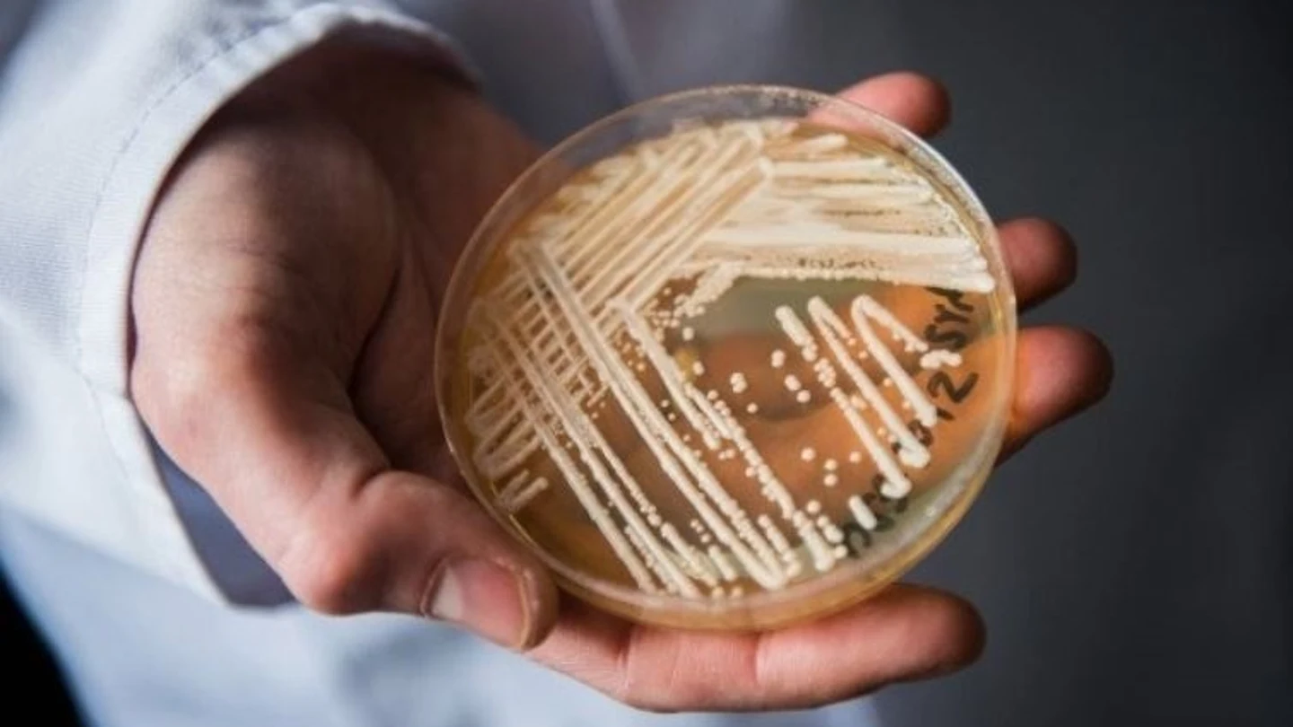 Qué es el hongo 'candida auris': síntomas y tratamiento Candida auris