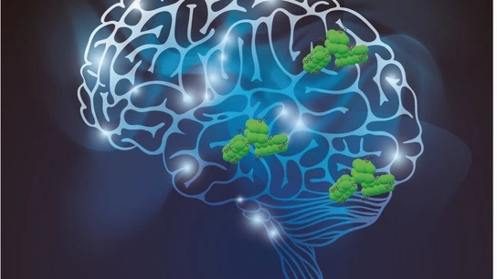 ¿Se puede prevenir el párkinson? Estas son las causas de esta enfermedad neurológica ¿Se puede prevenir el párkinson? Estas son las causas de esta enfermedad neurológica