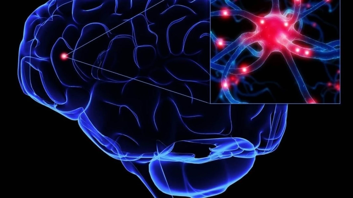 Parkinson Parkinson