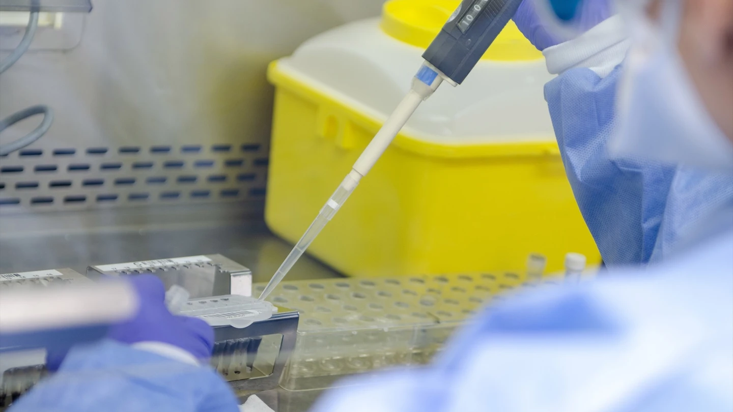 Análisis de las muestras de la viruela del mono Análisis de las muestras de la viruela del mono