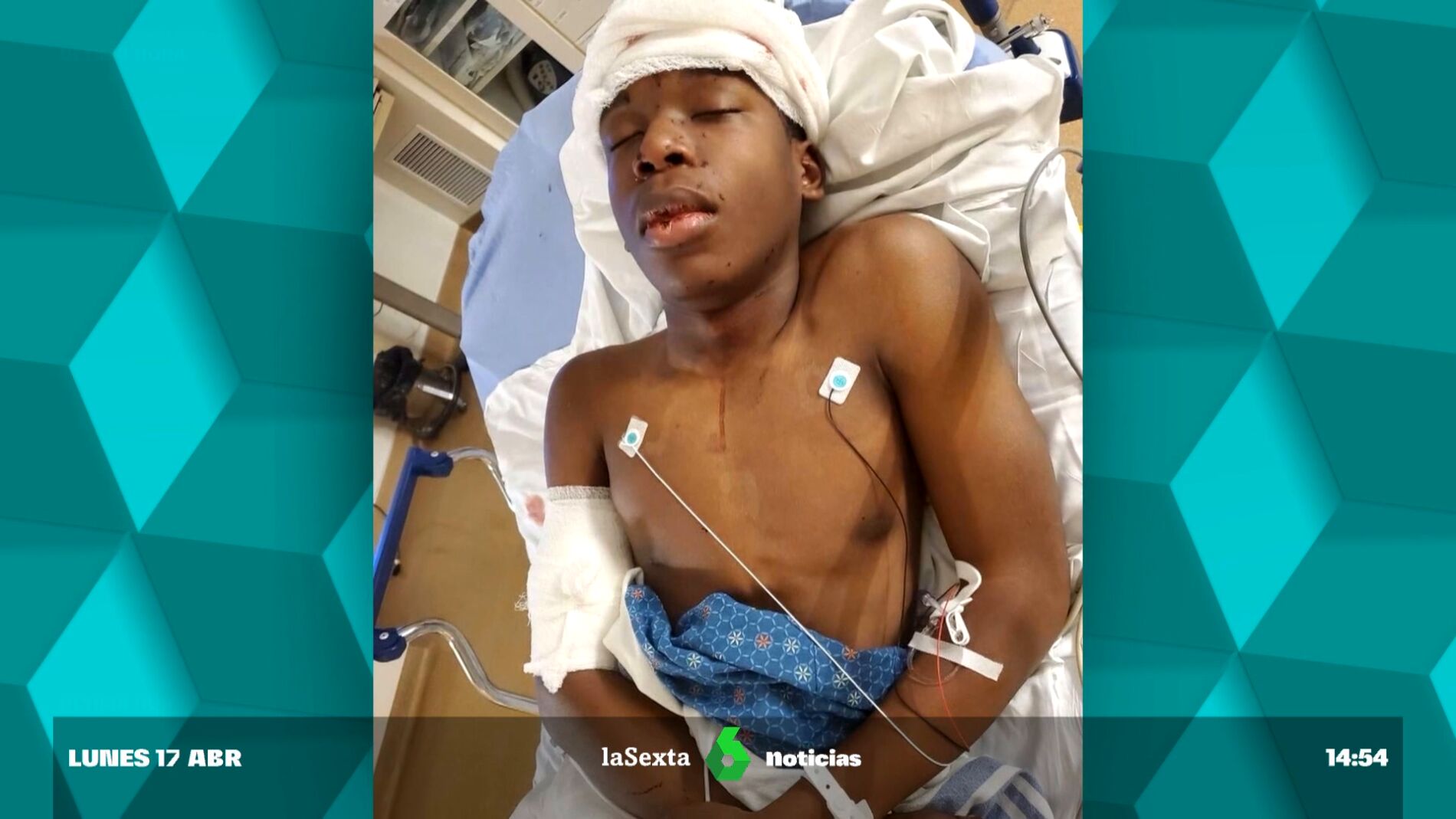 Disparan en la cabeza a un joven negro de 16 años tras tocar el timbre de  una casa equivocada en EEUU