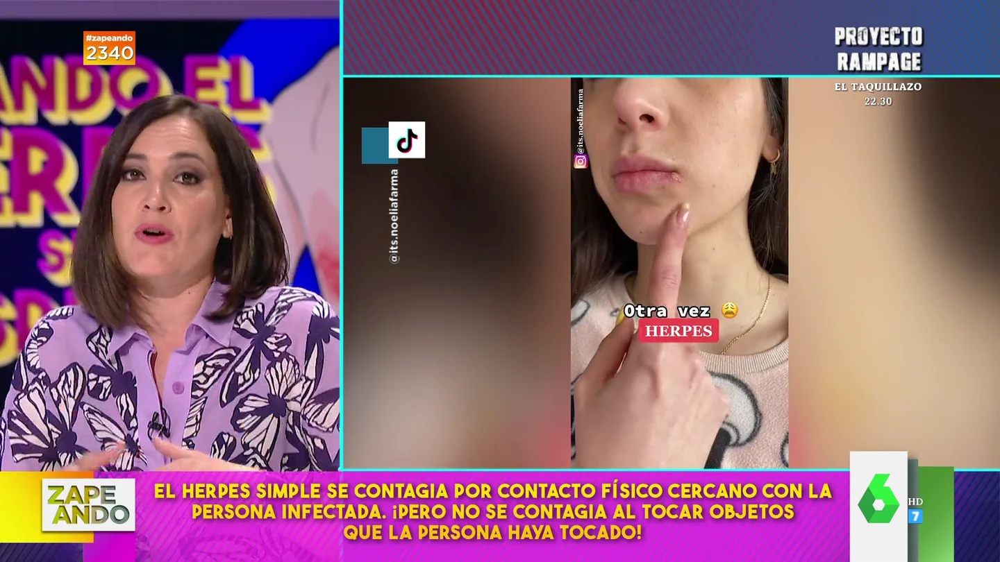 Boticaria García explica cómo se contagia el herpes labial Boticaria García explica cómo se contagia el herpes labial