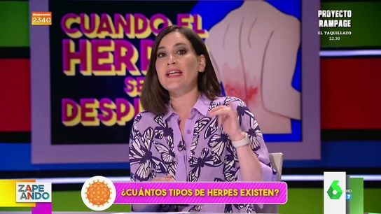 Boticaria García explica los distintos tipos de herpes que hay y aclara que el 80% de la población es portadora Boticaria García explica los distintos tipos de herpes que hay y aclara que el 80% de la población es portadora