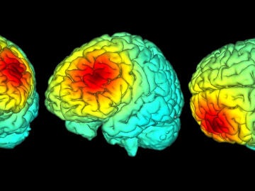 Como modular las predicciones emocionales con estimulacion cerebral no invasiva