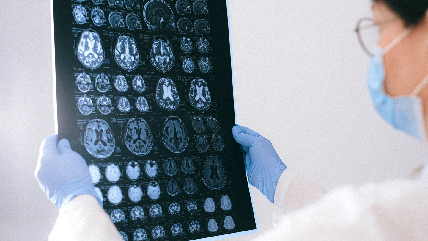 Qué es la meningitis y cuáles son sus principales riesgos Qué es la meningitis y cuáles son sus principales riesgos