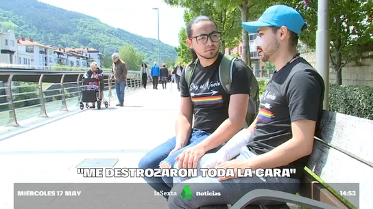 Brutal agresión homófoba en Guipizkoa: rompen la nariz y la muñeca a un joven cuando iba con su novio al grito de 'maricones' Brutal agresión homófoba en Guipizkoa: rompen la nariz y la muñeca a un joven cuando iba con su novio al grito de 'maricones'