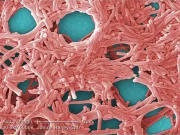 Bacteria gramnegativa Legionella pneumophilia Bacteria gramnegativa Legionella pneumophilia