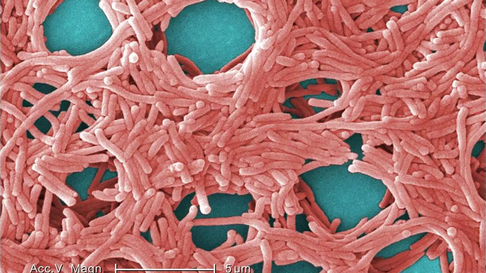 Bacteria gramnegativa Legionella pneumophilia 