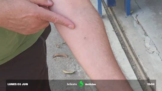 si te pica notifica si te pica notifica
