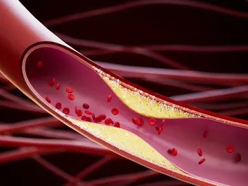 Colesterol Colesterol